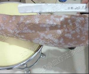 3���Ƴ������м��