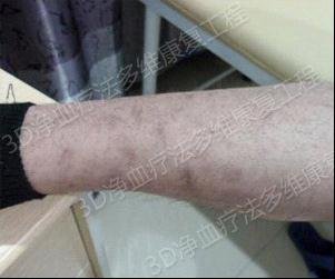 3���Ƴ������м��