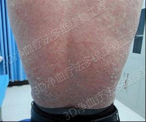 �����շ�������ʹ