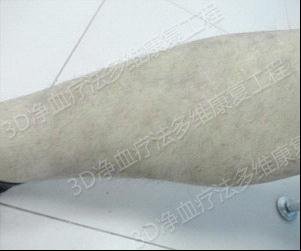 ��Ѫ�Ʒ����һָ�����