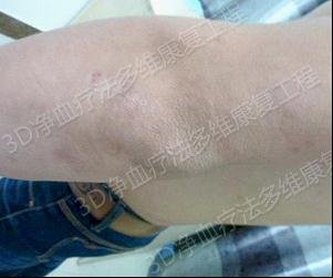 �����޸���Ϊ��Ч