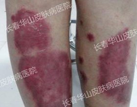 ��м�����ˣ������ع�