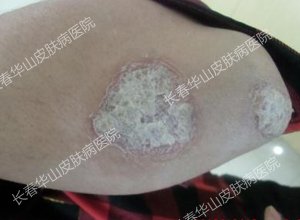 15�������ⲿ��м��