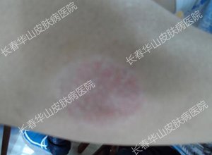 15�������ⲿ��м��