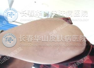 15�������ⲿ��м��