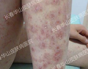 ��м�����ˣ������ഺ����