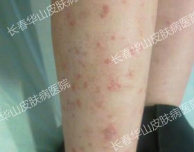 ��м�����ˣ������ഺ����