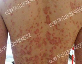 ����Ƥ����������