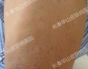 ����Ƥ����������