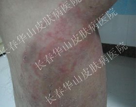 �淶���ƣ�����м��˵�ټ���