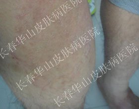 �淶���ƣ�����м��˵�ټ���