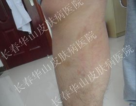 �淶���ƣ�����м��˵�ټ���