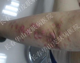 û����м����������