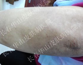 û����м����������