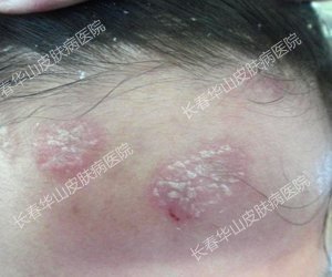 Ƥ��û�ˣ��ഺ���磡