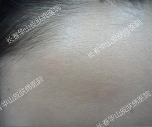 Ƥ��û�ˣ��ഺ���磡