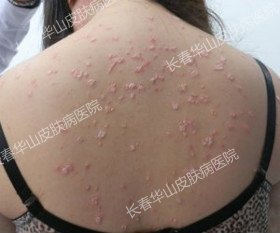 �����ػ���Ů��սʤ��м��