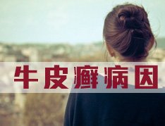 牛皮癣加重有什么原因