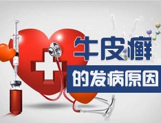 牛皮癣由什么因素导致