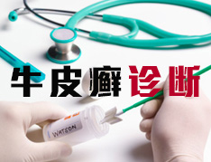 牛皮癣诊断要点有哪些